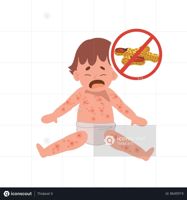 Baby Food Allergy from peanut  Illustration