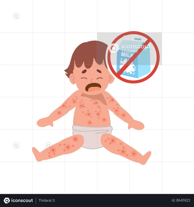 Baby with skin rash  Illustration