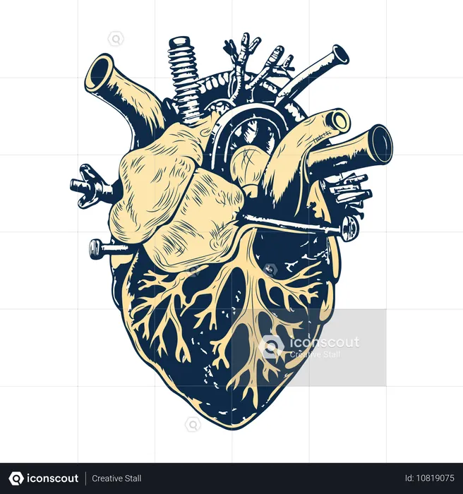 Cirurgia cardíaca  Ilustração