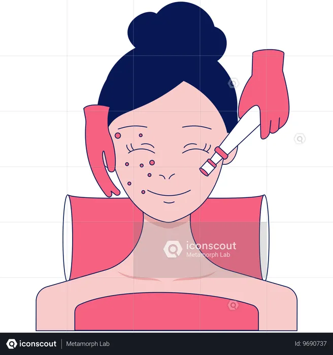 Collagen Induction Therapy  Illustration