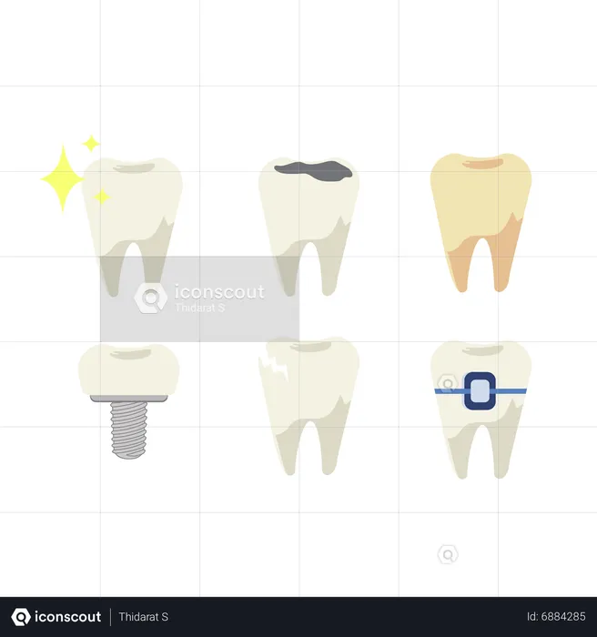 Conjunto de dentes com diferentes tipos de doenças dentárias  Ilustração