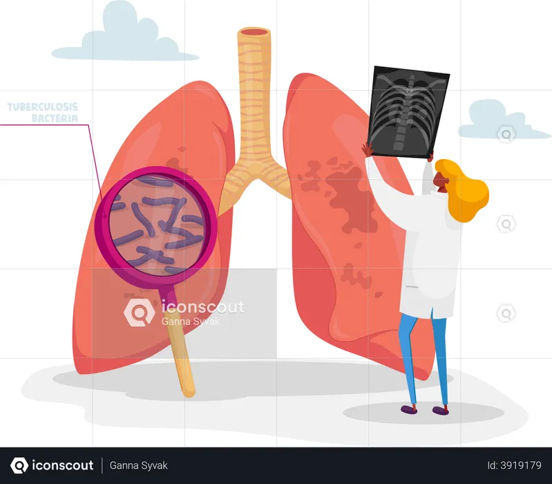 Doctor Holding X-ray Image of Lungs Learning Patient Fluorography with Tuberculosis or Pneumonia Disease  Illustration