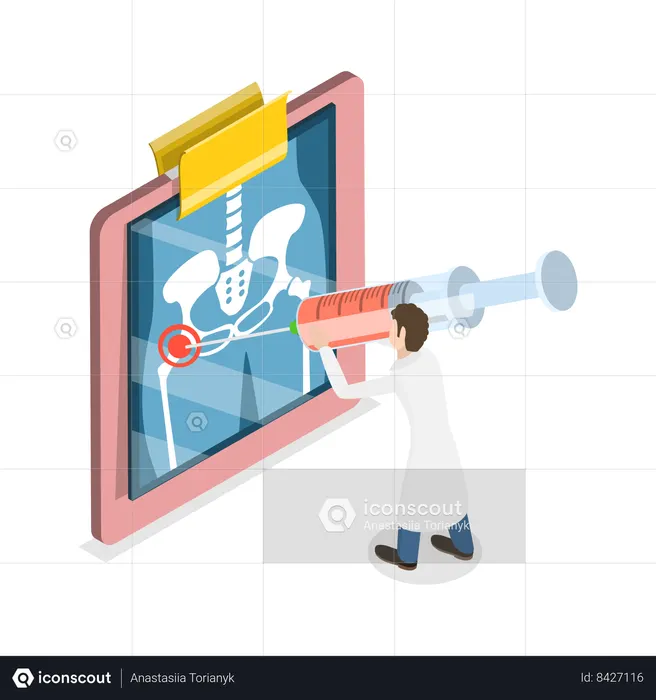 Doctor poniendo una inyección de cortisona en la articulación de la cadera.  Ilustración