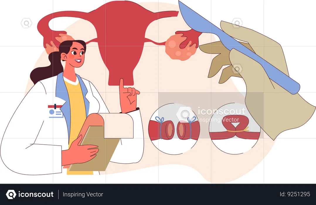 Doctor undertakes ovary surgery  Illustration