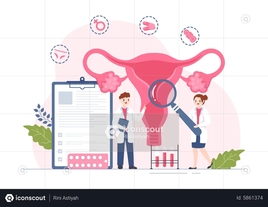 Ilustração de endometriose  Ilustração