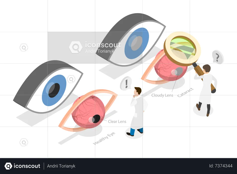 Eye Surgery  Illustration