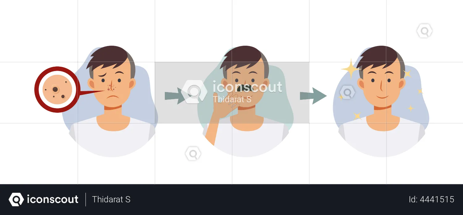 Facial skin treatment  Illustration