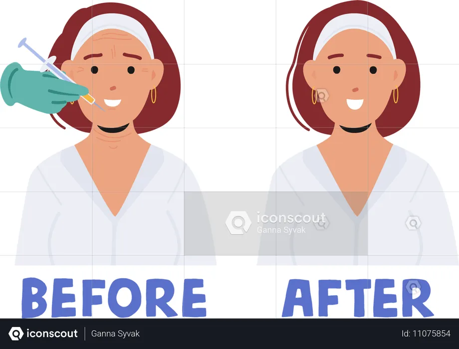 Female Face Before and After Beauty Injections  Illustration