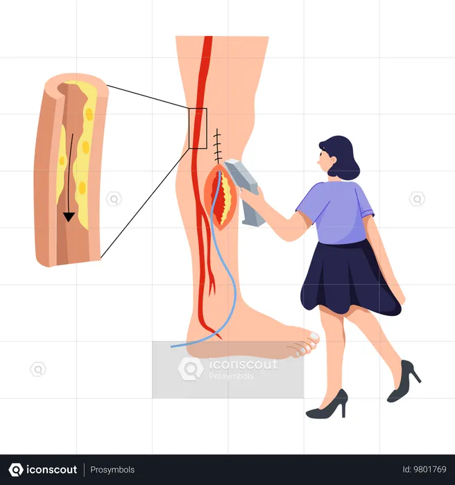 Femme faisant une chirurgie de la jambe  Illustration