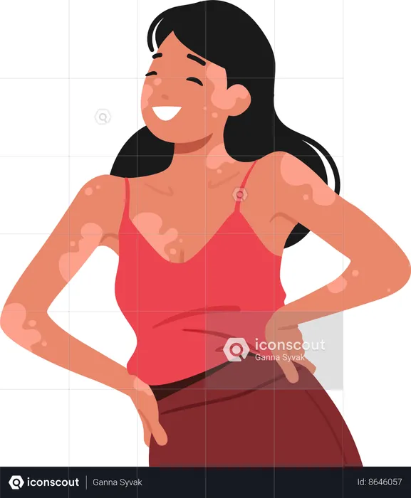 Femme Joyeuse Beauté Unique Avec Vitiligo  Illustration