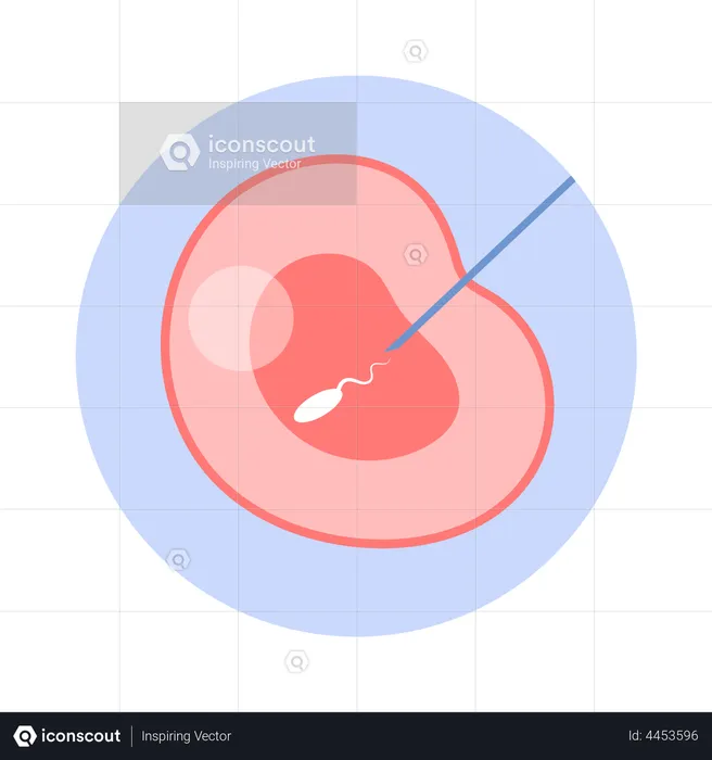 Fertilización artificial del óvulo de mujer.  Ilustración