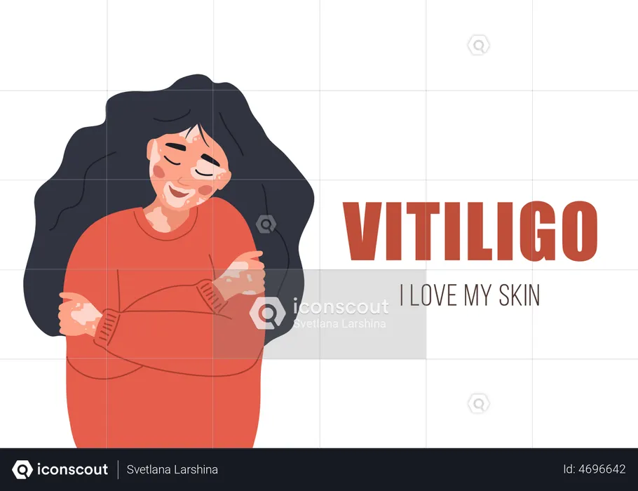 Fille atteinte de vitiligo  Illustration