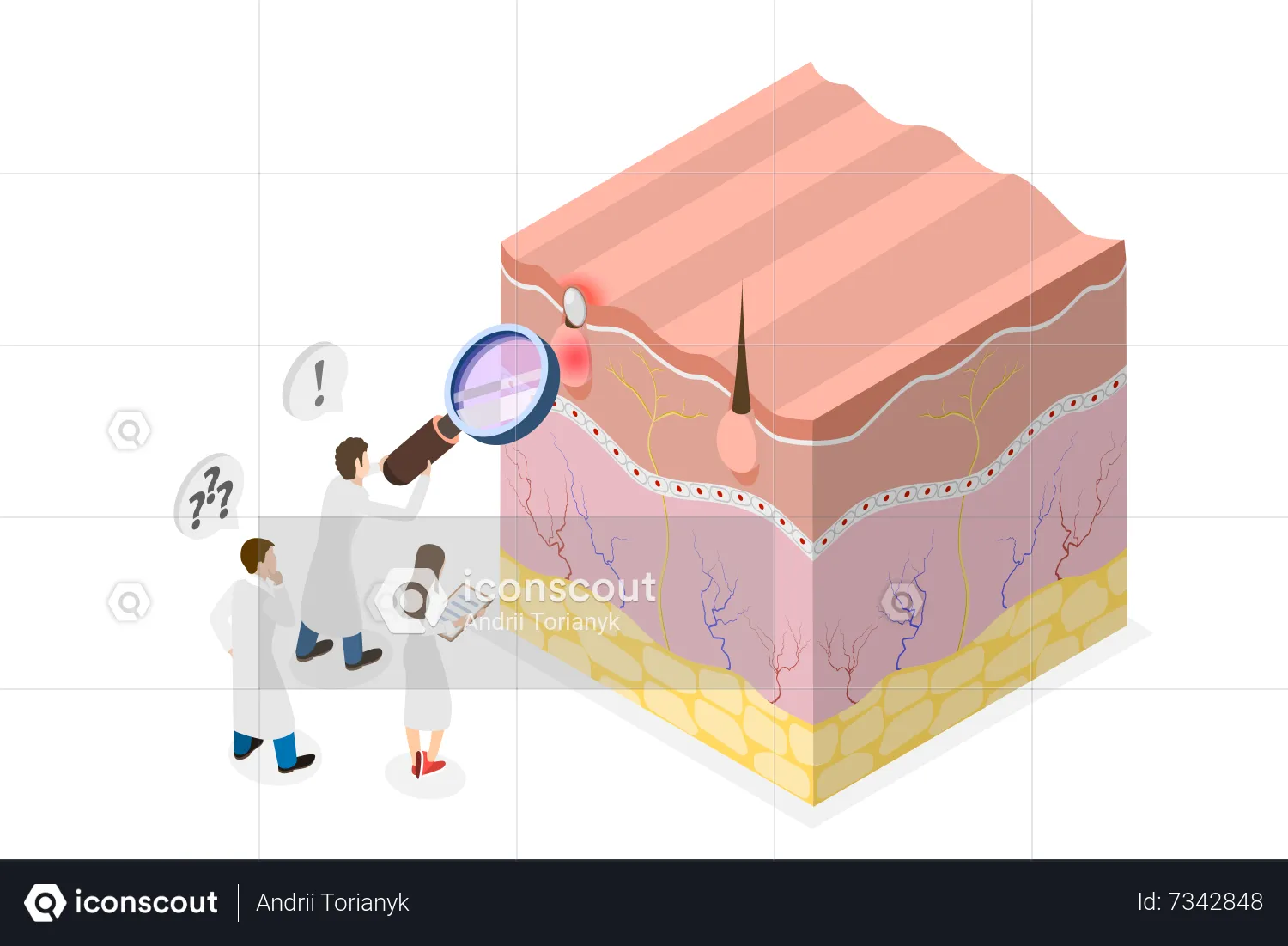 Best Formation of skin pimple Illustration download in PNG & Vector format