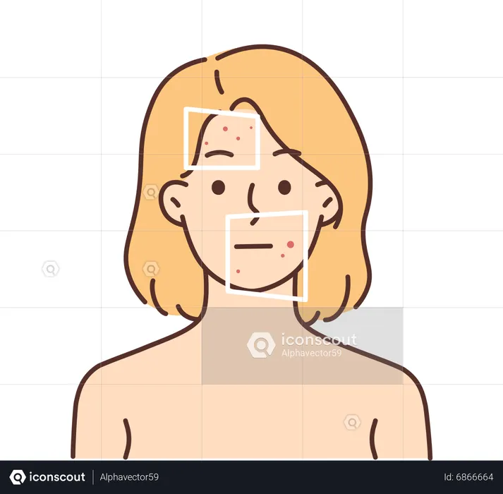 Girl having signs of acne on face  Illustration