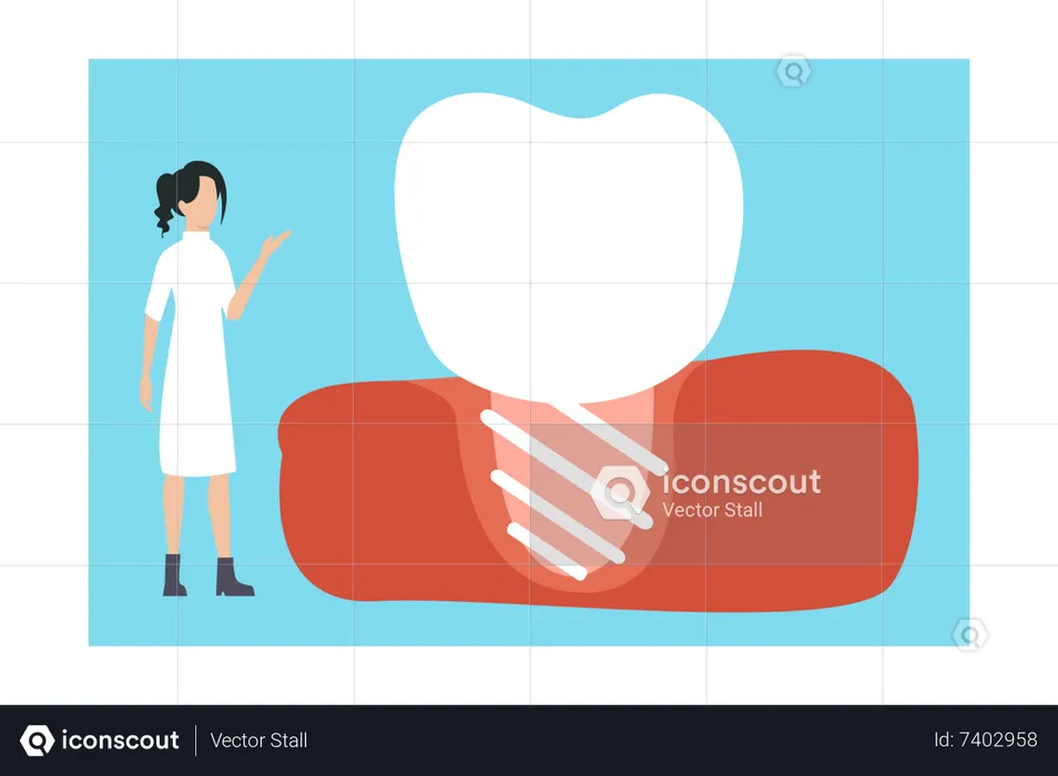 Girl looking at dental implant  Illustration