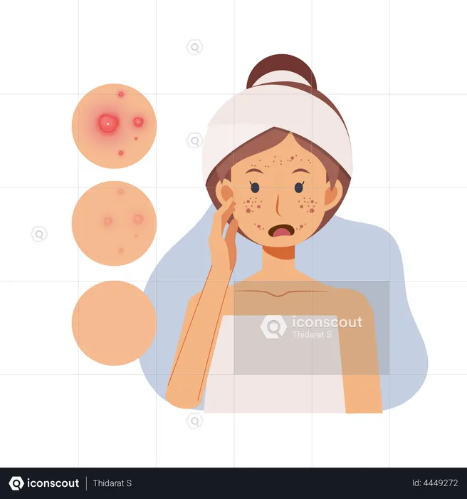 Girl with Acne On Face  Illustration