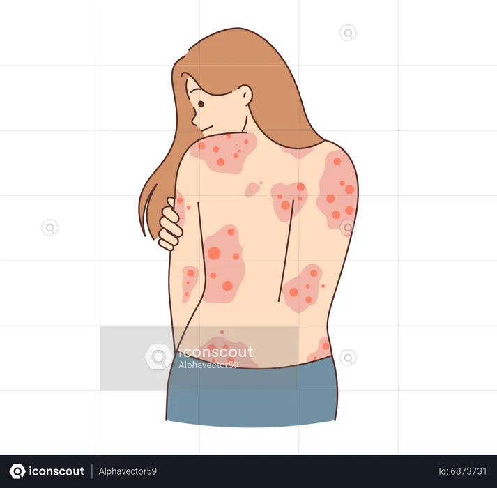 Girl with skin rashes  Illustration