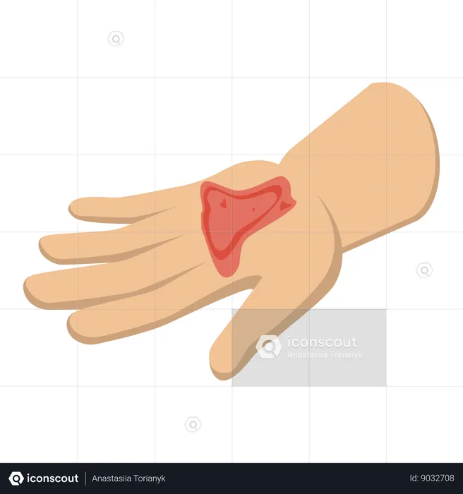 Hand with physical injury  Illustration