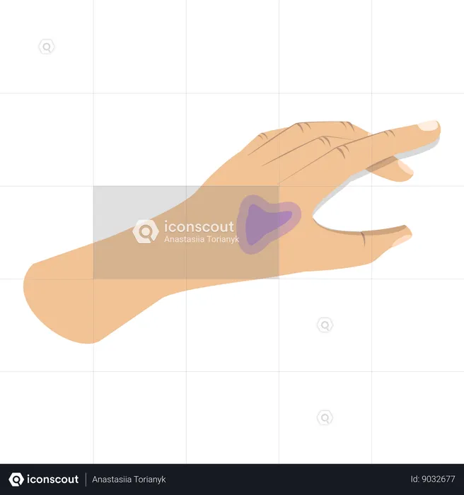 Hand with physical injury  Illustration