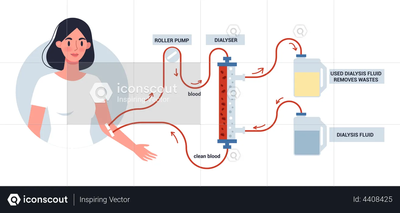 Hémodialyse pour le traitement des reins  Illustration