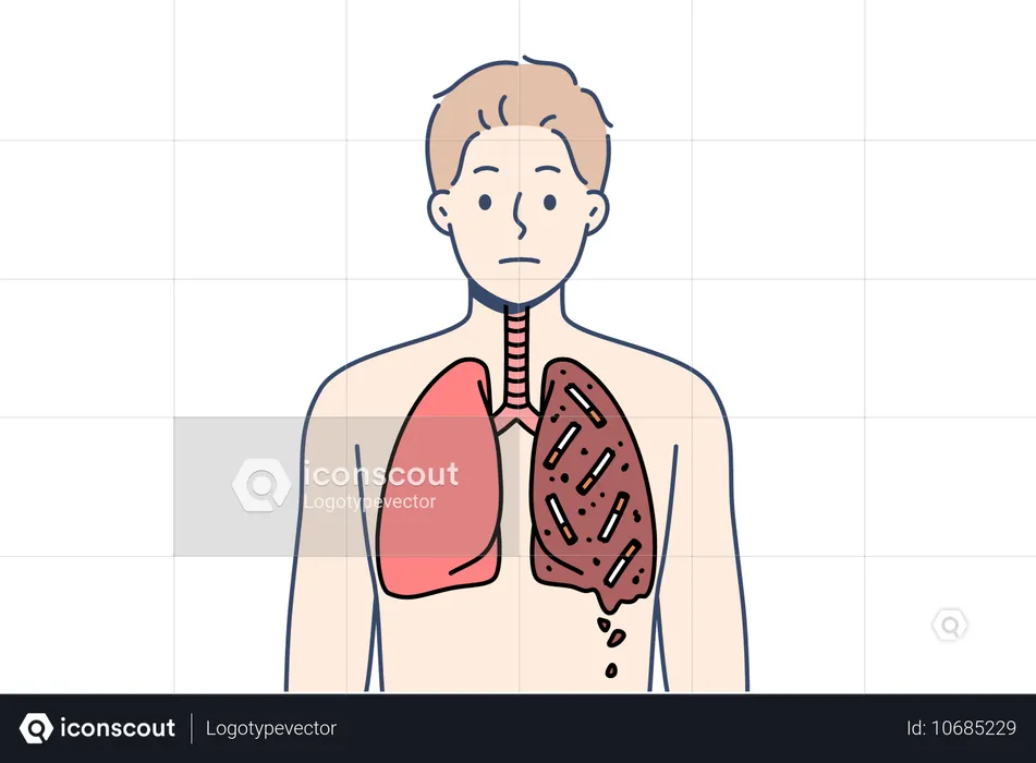 Homem fumante com pulmões destruídos  Ilustração