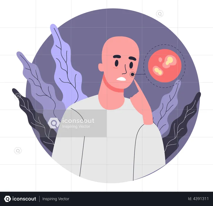 Homem que sofre de ulceração oral devido à quimioterapia  Ilustração