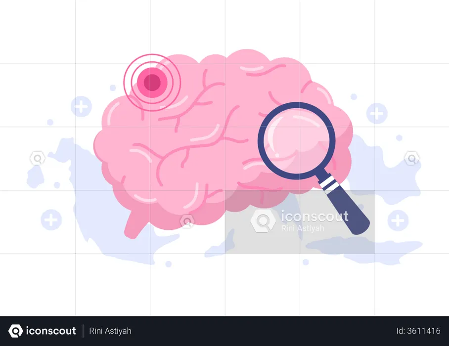 Hypertension Stroke  Illustration