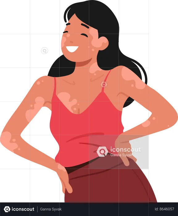 Joyful Woman Unique Beauty With Vitiligo  Illustration