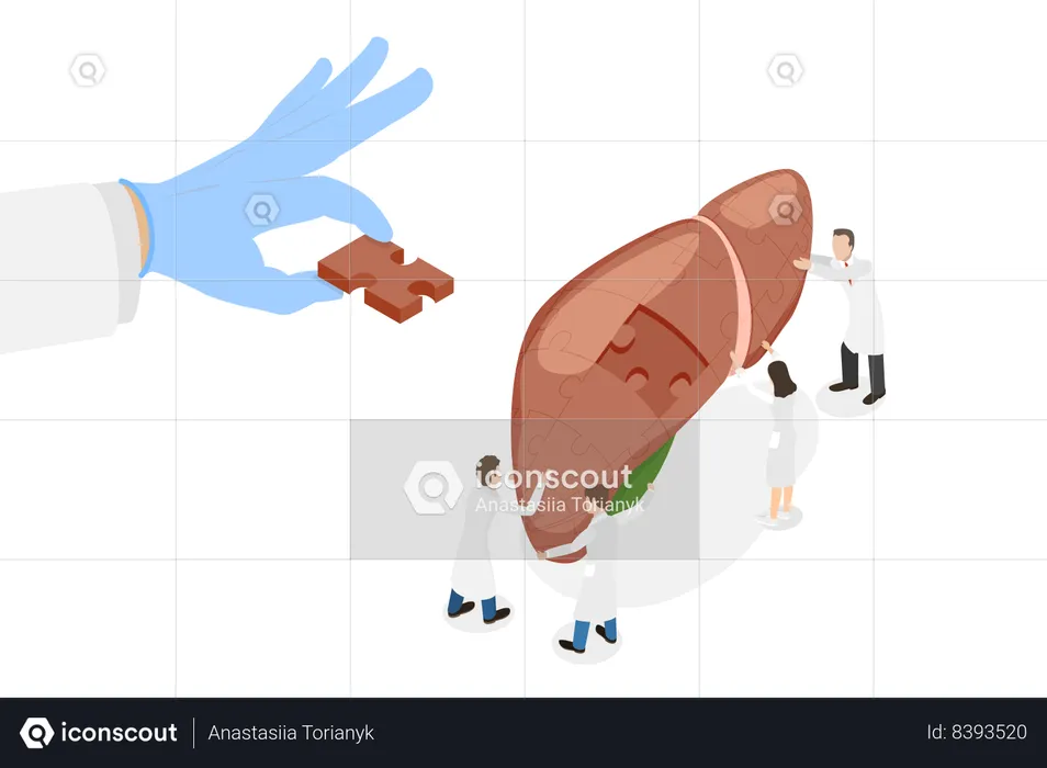 Liver Transplantation  Illustration