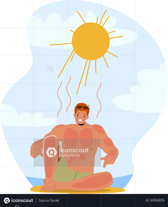 Man Grimacing In Pain From Sunburn On Beach  Illustration