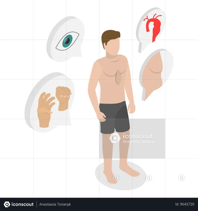 Man have Marfan Syndrome  Illustration