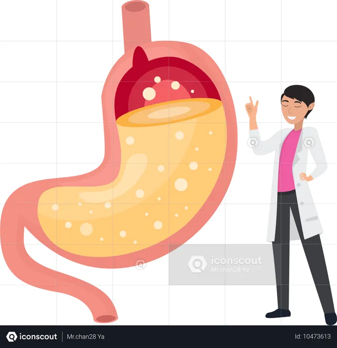 Especialista médico explica doença do refluxo ácido e gastrite  Ilustração