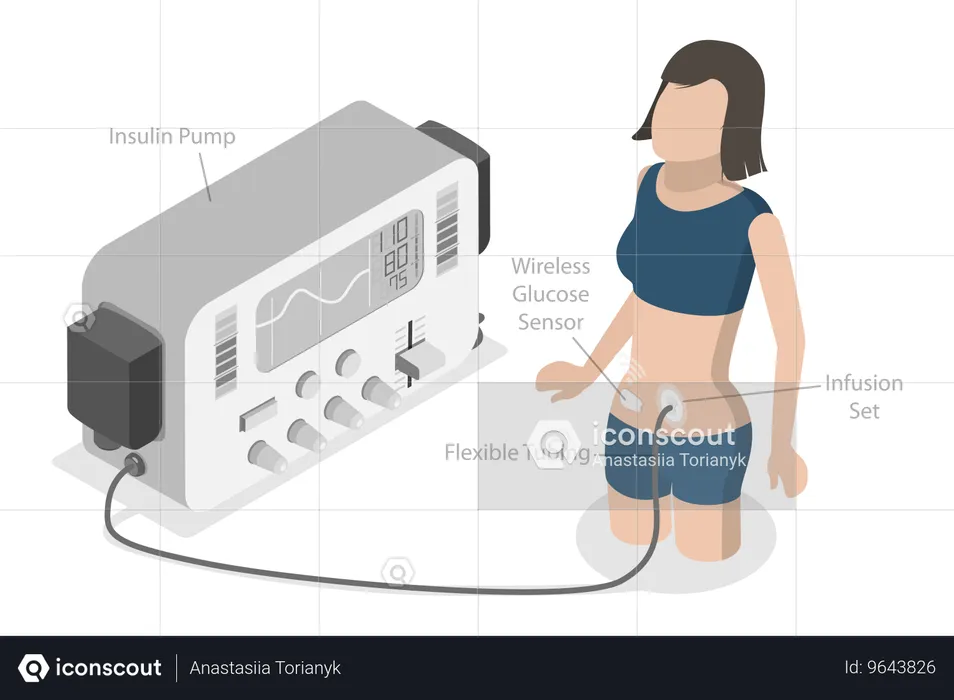 Menina com bomba de infusão de insulina  Ilustração