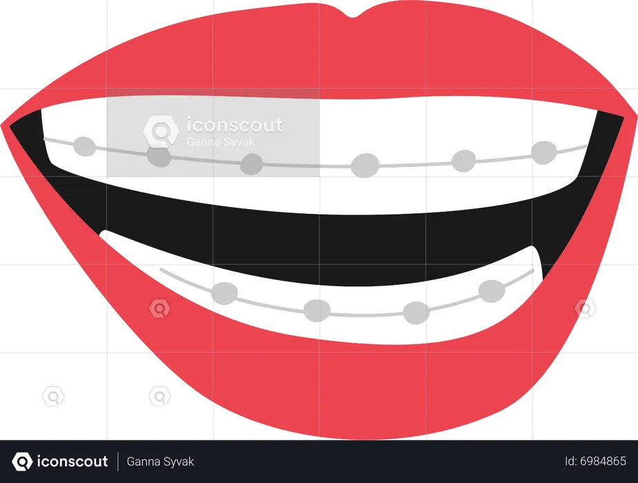 Mouth With Braces Features  Illustration