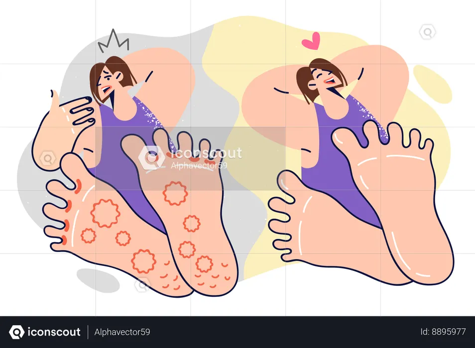 Mujer con hongos en los pies antes y después de usar ungüento medicinal  Ilustración