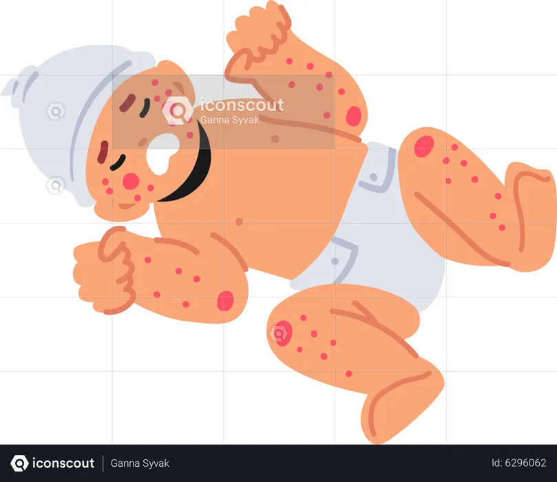 Niño recién nacido con síntomas de alergia alimentaria  Ilustración