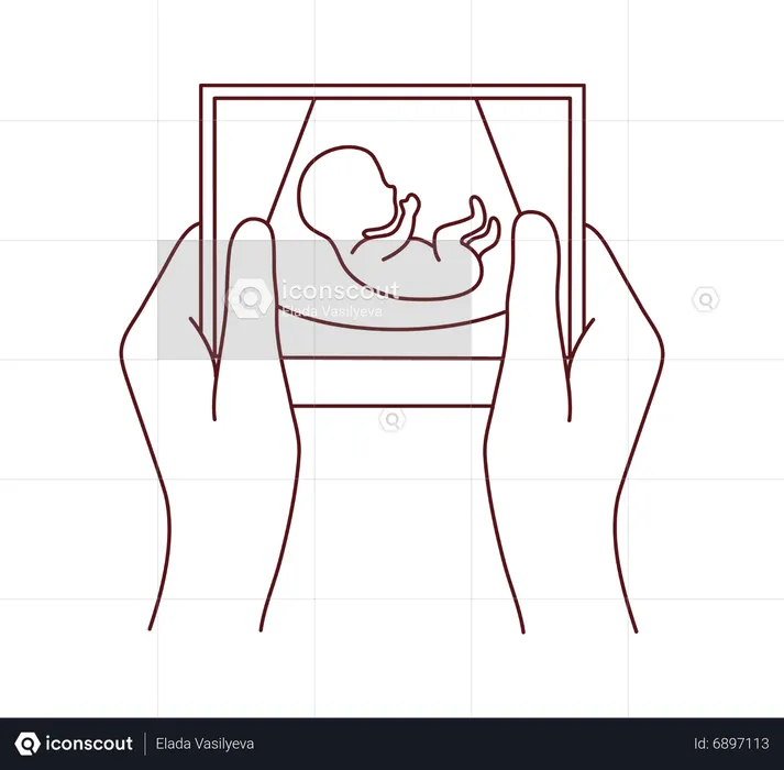 Pregnant womb picture  Illustration