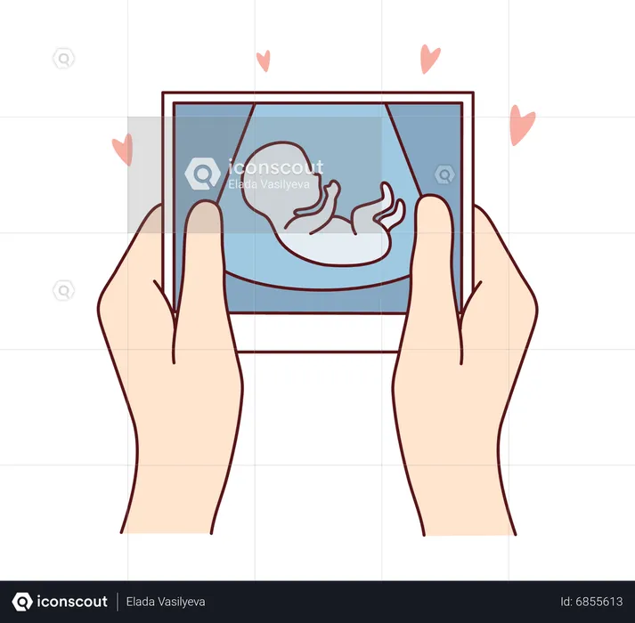 Pregnant womb picture  Illustration