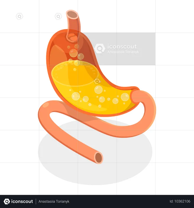 Problèmes d'estomac  Illustration