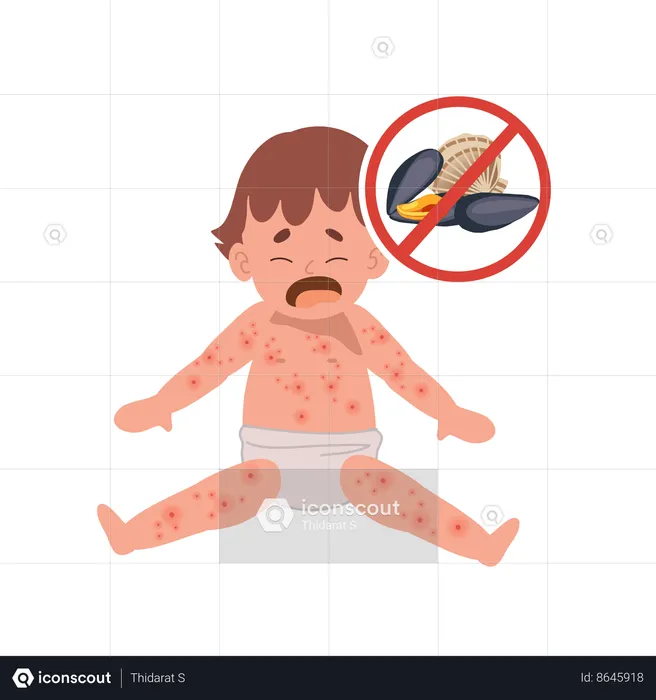 Reacciones alérgicas en bebés  Ilustración