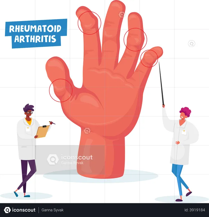 Rheumatoid Arthritis  Illustration