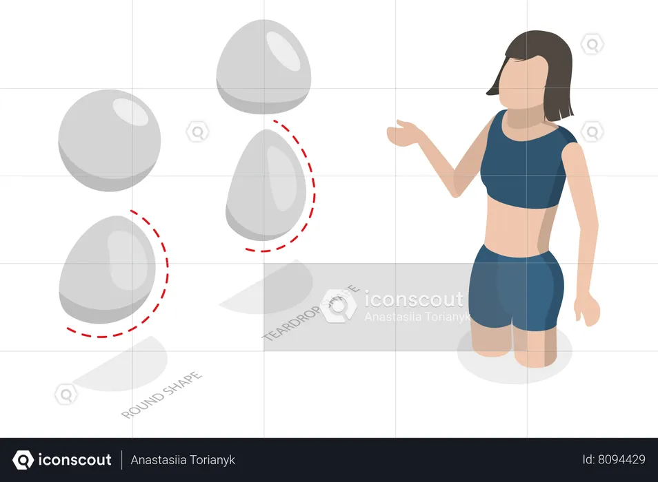 Tipos de implantes mamários  Ilustração