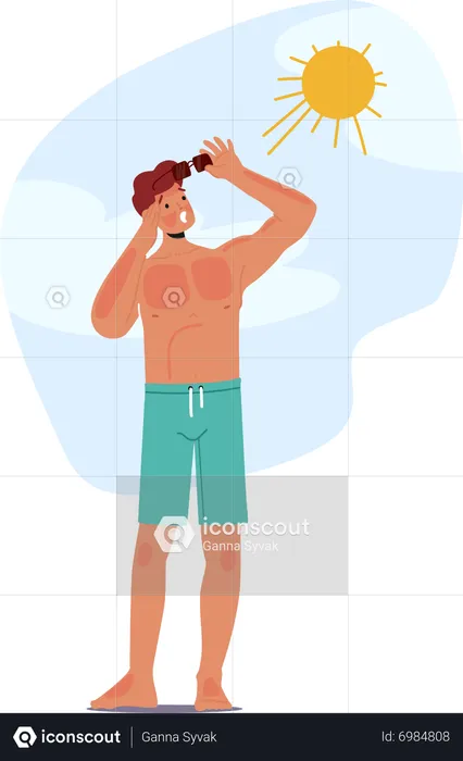 Un homme souffre d’un coup de soleil douloureux sur la plage  Illustration