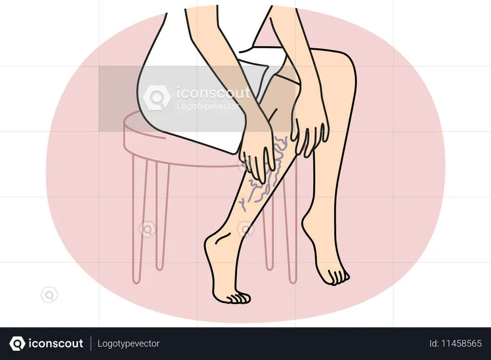 Woman touching legs with varicose veins  Illustration