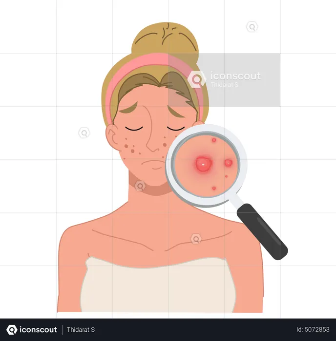 Woman with severe facial acne problem  Illustration