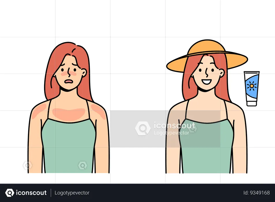 Woman with sunburn smiles after using sunscreen to protect from ultraviolet light  Illustration