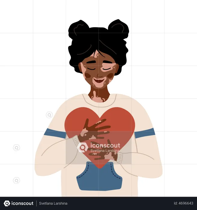 Woman with Vitiligo  Illustration