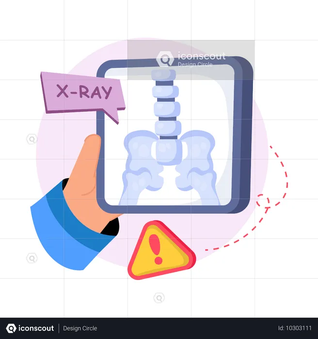 X-ray report  Illustration