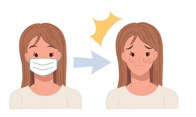 Acne caused due to wearing face mask Illustration