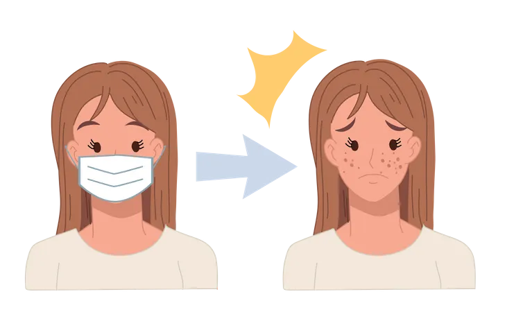 Acne caused due to wearing face mask Illustration
